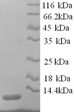 (Tris-Glycine gel) Discontinuous SDS-PAGE (reduced) with 5% enrichment gel and 15% separation gel.